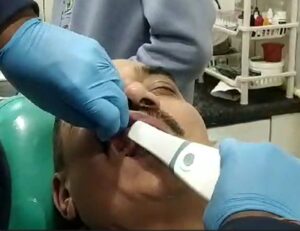intraoral